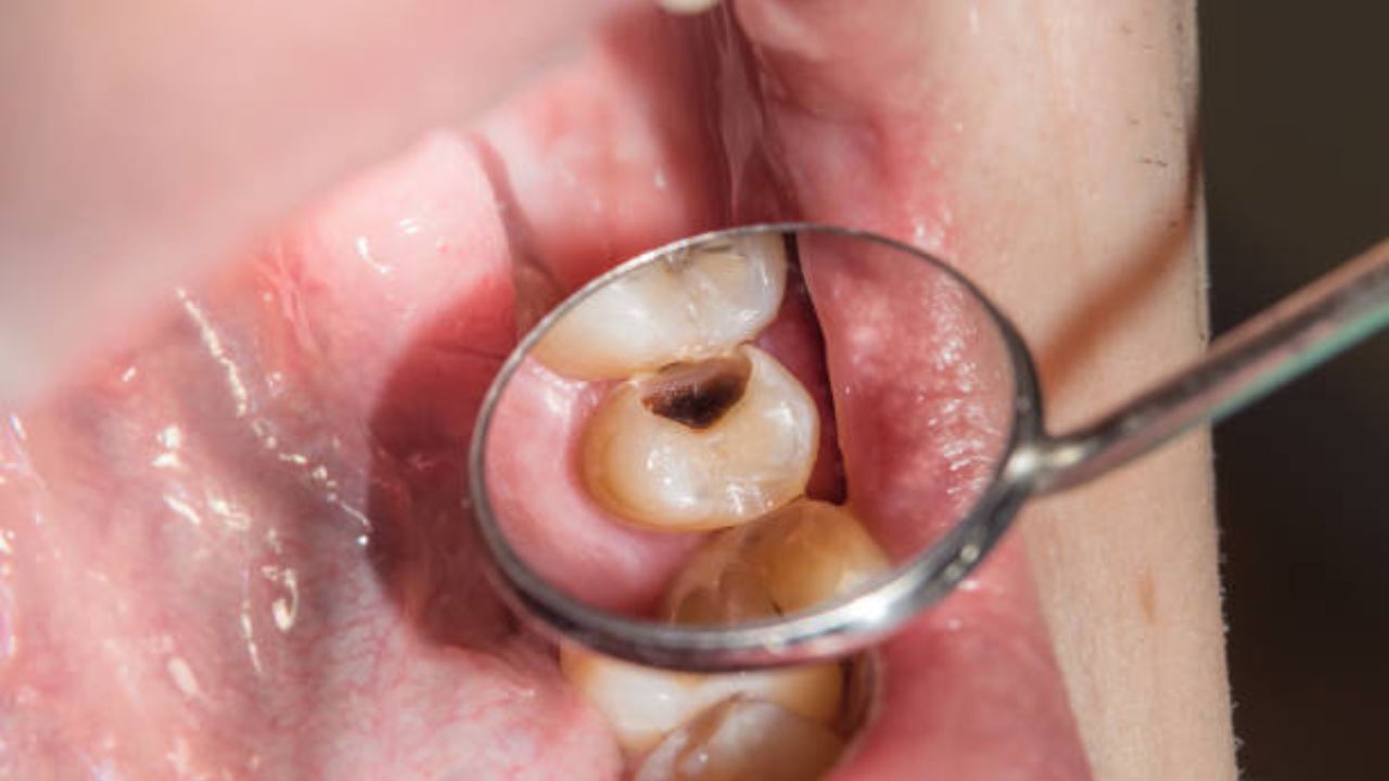 Teeth Whitening Remedies: जेवल्यानंतर लगेच करा ‘या’ औषधी पदार्थांचे सेवन, दातांच्या गंभीर समस्यांपासून मिळेल कायमचा आराम