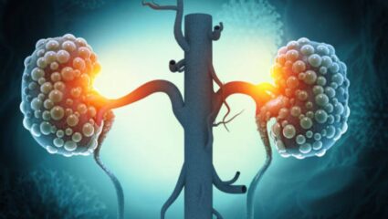 किडनीच्या आजाराची लागण झाल्यानंतर त्वचेवर दिसून येतात ‘ही’ गंभीर लक्षणे, वेळीच सावध होऊन शरीराची घ्या काळजी