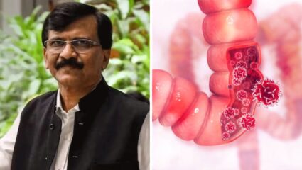 शिवसेना खासदार संजय राऊत यांना आतड्यांच्या कॅन्सरची लागण?शरीरात दिसणाऱ्या ‘या’ लक्षणांकडे चुकूनही करू नका दुर्लक्ष