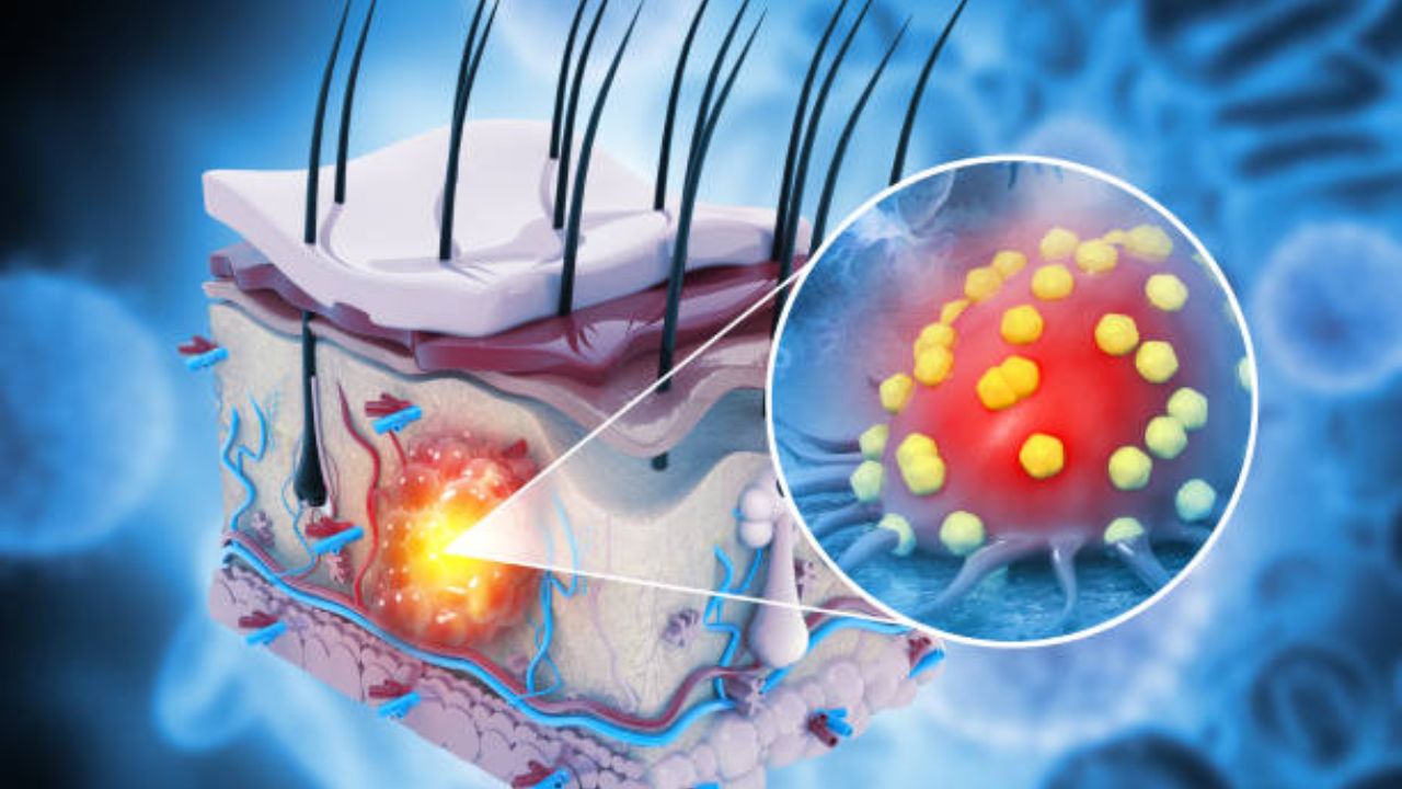 कॉस्मेटिक्स, क्रीम्स आणि डिओड्रंट्समधील केमिकल्समुळे वाढतोय त्वचा कर्करोगाचा धोका, वेळीच व्हा सावध