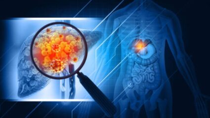 लिव्हर कॅन्सरचा धोका होईल कायमचा नष्ट! Liver मध्ये वाढलेली चरबी कमी करण्यासाठी आहारात करा ‘या’ घरगुती पेयांचे सेवन