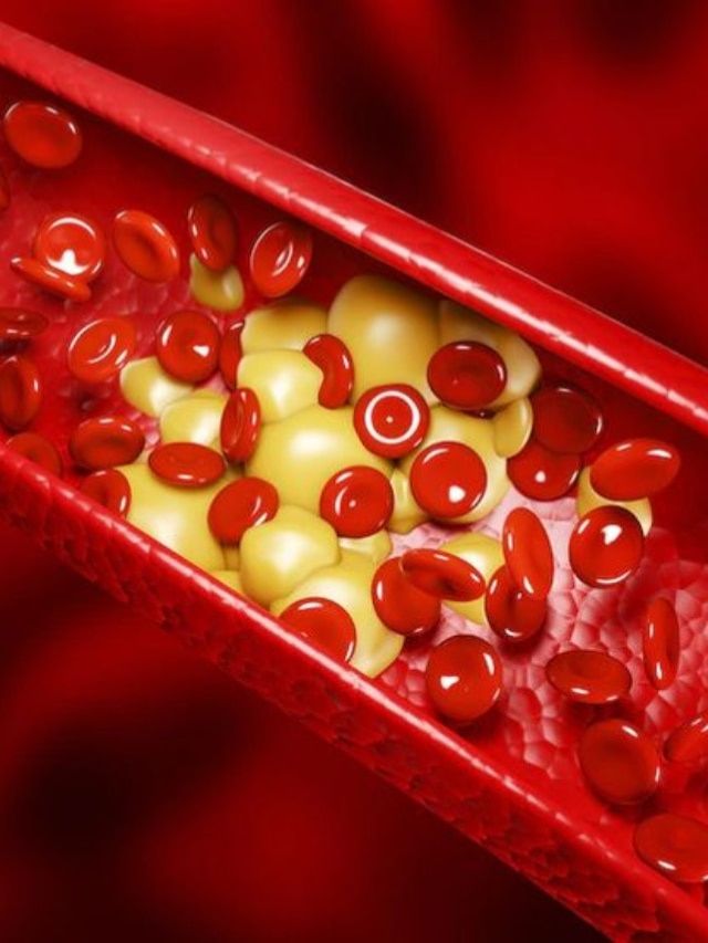 रोज सकाळी चावून खा हा पांढरा पदार्थ, बॅड कोलेस्ट्रॉल होईल छुमंतर