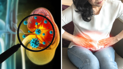 Kidney Stone: हिवाळ्यात वाढतेय मुतखड्याची समस्या, कारणे, लक्षणे आणि उपाय जाणून घ्या
