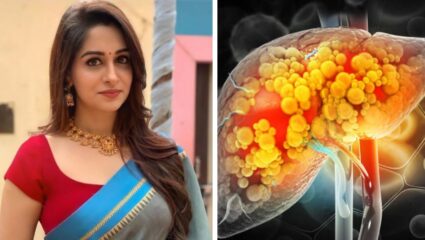 मानवी लिव्हरची ही विशेष गोष्ट माहिती आहे का? दीपिका कक्करचा 22% सडलेला यकृत आला होता कापण्यात; काय आहेत उपचार?