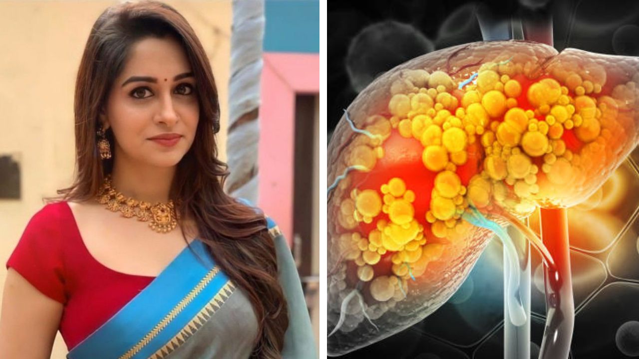 मानवी लिव्हरची ही विशेष गोष्ट माहिती आहे का? दीपिका कक्करचा 22% सडलेला यकृत आला होता कापण्यात; काय आहेत उपचार?