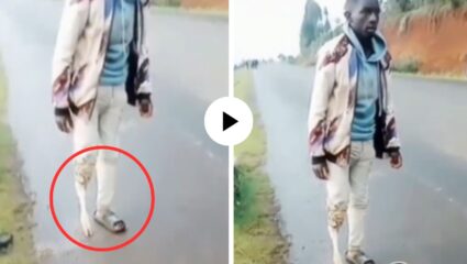 अरे बापरे! पाय तुटला म्हणून डॉक्टरांनी रुग्णाला बसवला बकरीचा पाय, दुसऱ्या क्षणाला व्यक्ती चालूही लागला; Video Viral