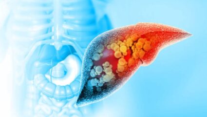 लिव्हरमध्ये अडकलेला सर्व कचरा आपोपाप पडेल बाहेर, आचार्य बाळकृष्णांनी सांगितला उपाय; फॅटी लिव्हरसाठी ठरेल रामबाण