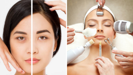 लग्नापूर्वी उजळ त्वचा हवीये, ‘अशी’ घ्या तुमच्या त्वचेची काळजी, नवऱ्याची नजरच हटणार नाही