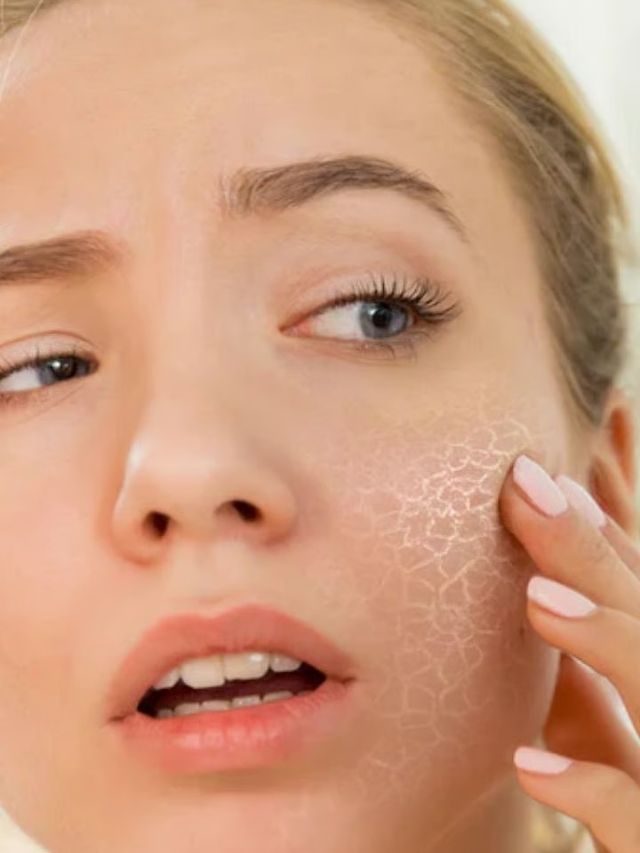 बदलत्या वातावरणात अशी घ्या स्किनची काळजी