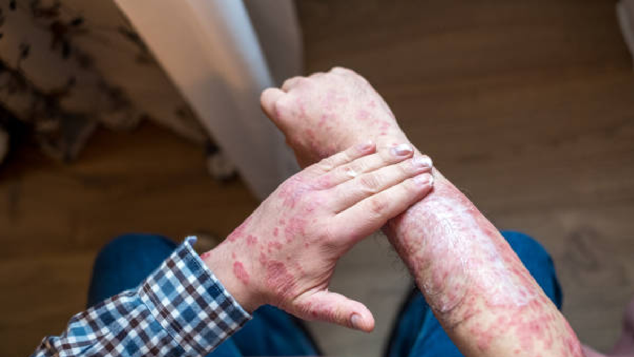 Navarashtra Special: हिवाळ्यात पाण्याकडे दुर्लक्ष करताय? वेळीच सावध व्हा; नाहीतर..