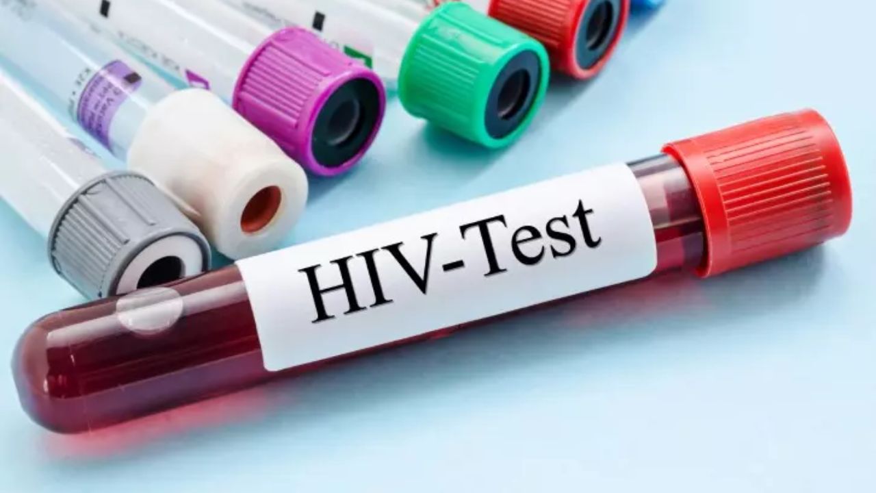HIV Patient : एकाच जिल्ह्यामध्ये HIV चा कहर; तब्बल 7400 लोकांना झाली बाधा, लग्नाबाबत डॉक्टरांचा कडक इशारा