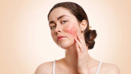 थंडीमुळे त्वचा कोमेजली आहे? मग गुलाब पाण्यात मिक्स करून लावा ‘हा’ पदार्थ, चेहऱ्यावर काळे डाग होतील आठवडाभरात गायब