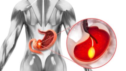 पोटात कायमच जडपणा जाणवतो? पोटाचा कॅन्सर झाल्यानंतर शरीरात दिसून येतात ‘ही’ महाभयंकर लक्षणे, कोणत्याही क्षणी ओढावेल मृत्यू