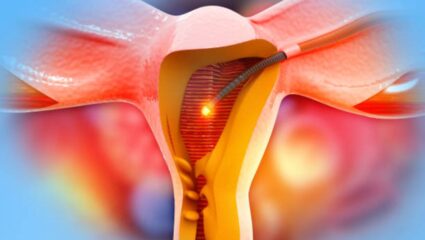 गर्भाशय काढल्यानंतर महिलांच्या शरीरात कोणते बदल होतात? गर्भाशयासंबंधित गंभीर समस्या कोणत्या कारणामुळे उद्भवतात