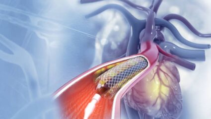 शरीराच्या ९० टक्के रक्तवाहिन्या ब्लॉक झाल्यानंतर दिसून येतात ‘ही’ भयानक लक्षणे, चुकूनही दुर्लक्ष केल्यास येईल हार्ट अटॅक किंवा स्ट