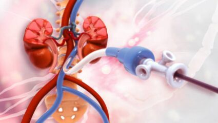 डायलिसिस केंद्रे नाममात्र दरात संस्थांना करून देणार उपलब्ध; ३० वर्षांसाठी केला जाणार करार, पालिकेचे पीपीपी मॉडेल