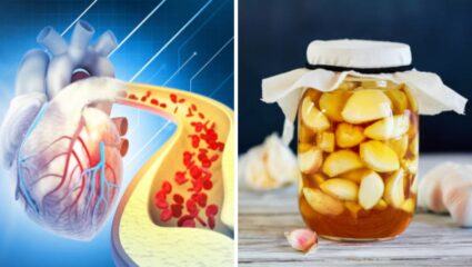 उच्च रक्तदाबाच्या गोळ्या होतील एका झटक्यात बंद! ‘या’ पद्धतीने नियमित खा लसूण पाकळ्या, रक्तवाहिन्या होतील मुळांपासून स्वच्छ