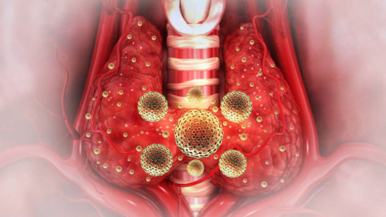 गारठ्यामुळे थ्रोट इन्फेक्शनचा वाढला जोर, ‘या’ आजारांचे आढळून येत आहेत सर्वाधिक रुग्ण, वेळीच घ्या उपचार