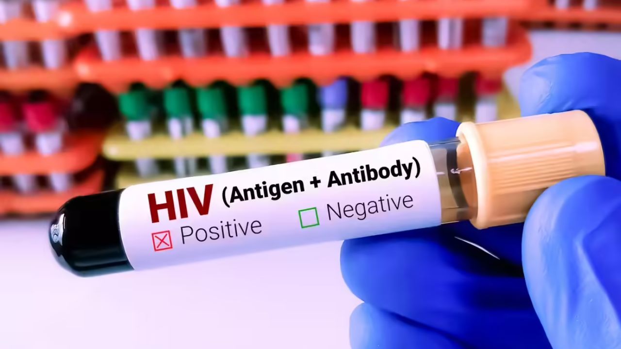 World AIDS Day 2025: जागतिक एड्स दिनानिमित्त चिंताजनक बातमी, गर्भवती महिलांमध्ये HIV संसर्ग वाढला