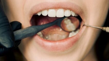 Tooth Regrowth Medicine: आता दात पडण्याची भीती कशाला? पुढच्या ४ वर्षांत तोंडात पुन्हा दात उगवणार; जपानचा मोठा चमत्कार