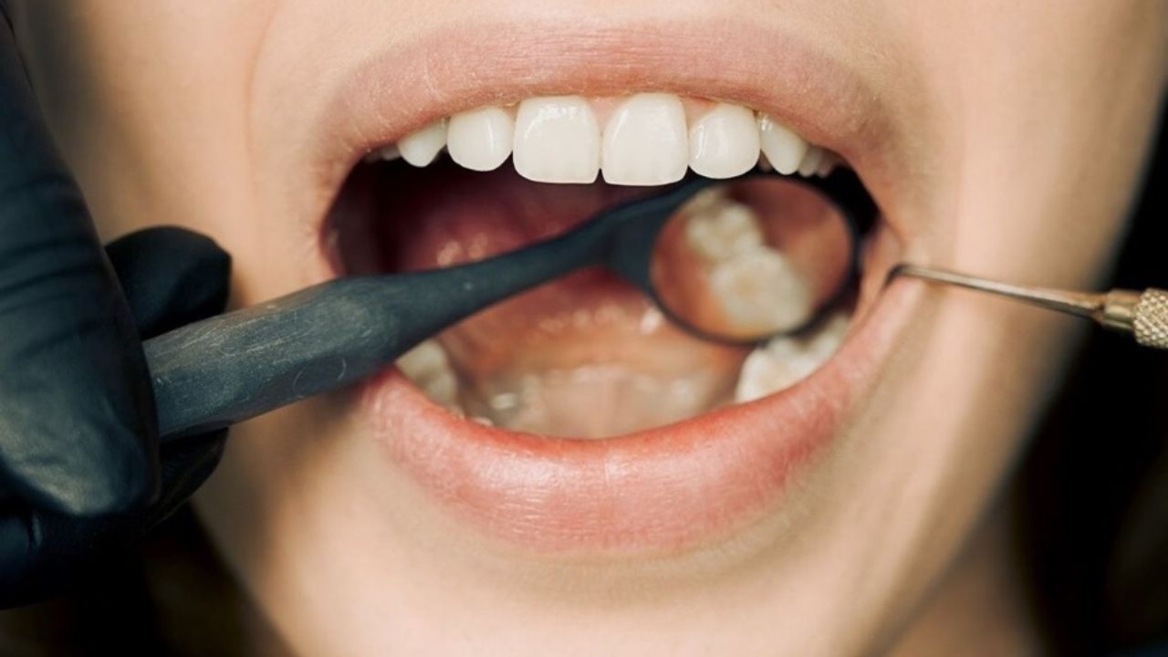 Tooth Regrowth Medicine: आता दात पडण्याची भीती कशाला? पुढच्या ४ वर्षांत तोंडात पुन्हा दात उगवणार; जपानचा मोठा चमत्कार