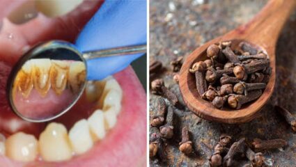 अन्नपदार्थांचे कण अडकून दातांमध्ये ठणके मारतात? दातांचे आरोग्य सुधरण्यासाठी करून पहा ‘हे’ घरगुती उपाय, दातांमधील जंतू जातील मरून