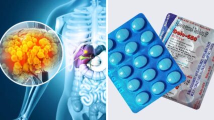 Dolo चा ओव्हरडोस लिव्हरसाठी ठरेल अतिशय घातक! चुकूनही करू नका सेवन, शरीरात दिसतील ‘ही’ गंभीर लक्षणे