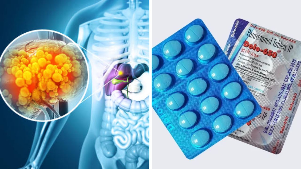 Dolo चा ओव्हरडोस लिव्हरसाठी ठरेल अतिशय घातक! चुकूनही करू नका सेवन, शरीरात दिसतील ‘ही’ गंभीर लक्षणे