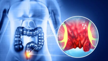 पोट व्यवस्थित स्वच्छ होत नाही? गरम पाण्यात मिक्स करून प्या ‘हा’ आयुर्वेदिक पदार्थ, आतड्यांची हालचाल होईल सुलभ