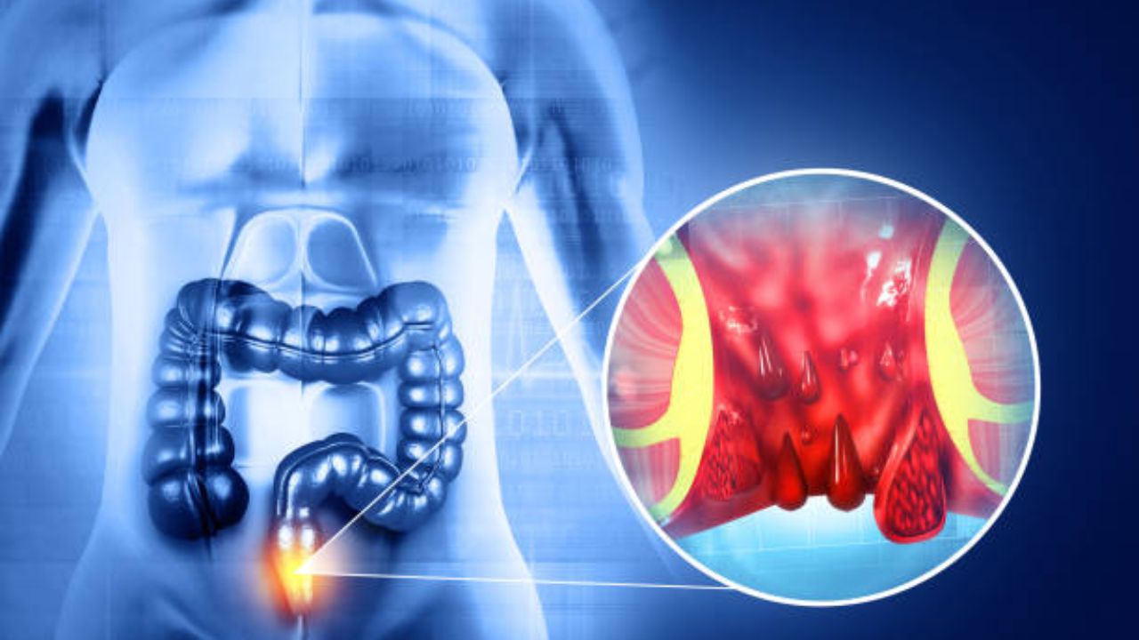 पोट व्यवस्थित स्वच्छ होत नाही? गरम पाण्यात मिक्स करून प्या ‘हा’ आयुर्वेदिक पदार्थ, आतड्यांची हालचाल होईल सुलभ