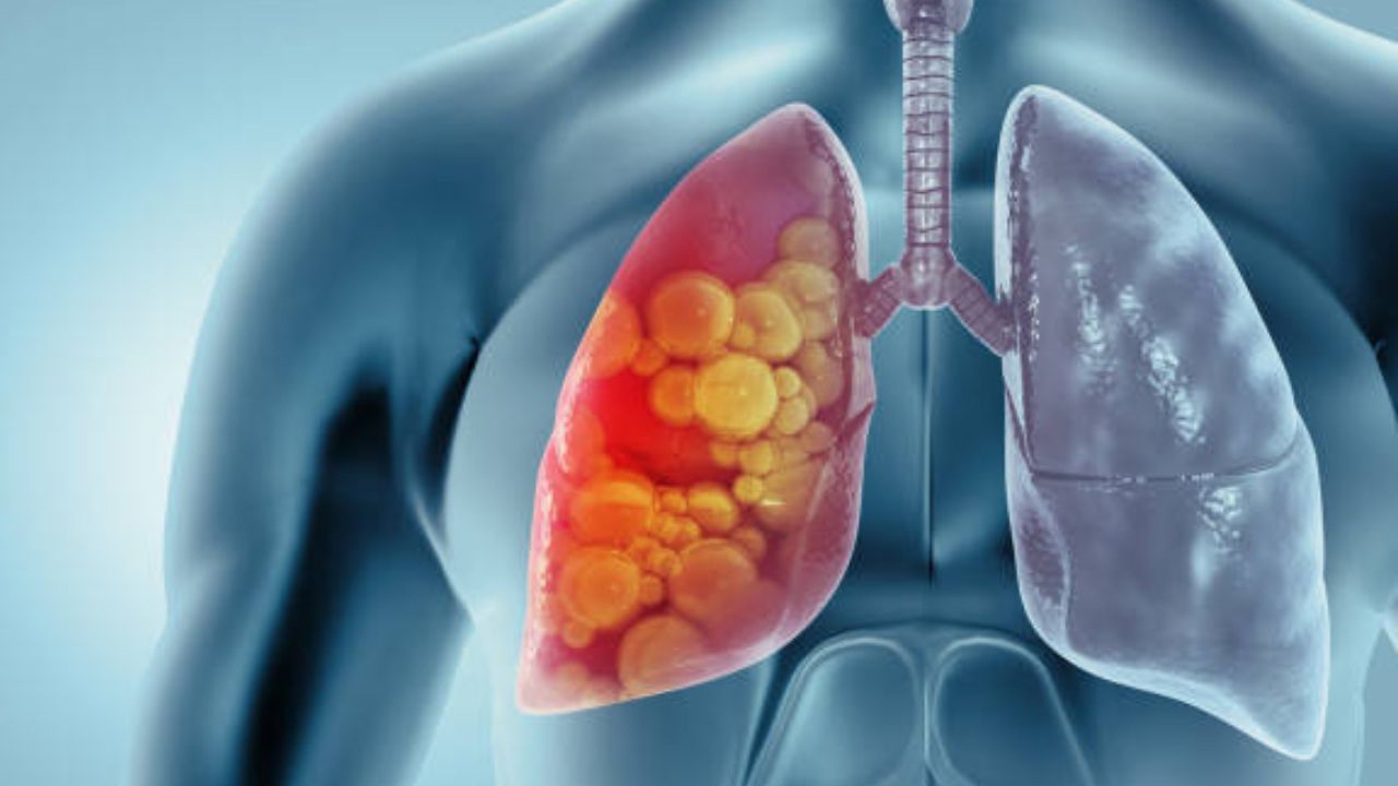 फुफ्फुसांमध्ये साचून राहिलेला घट्ट कफ क्षणार्धात पडून जाईल बाहेर! चावून खा ‘हे’ १ रुपयांचे पान, शरीरातील विषारी घाण होईल नष्ट