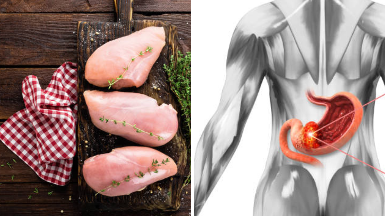 रोज चवीने खाताय Chicken? वाढू शकतो पोटाच्या कॅन्सरचा धोका, डॉक्टरांनी दिला इशारा