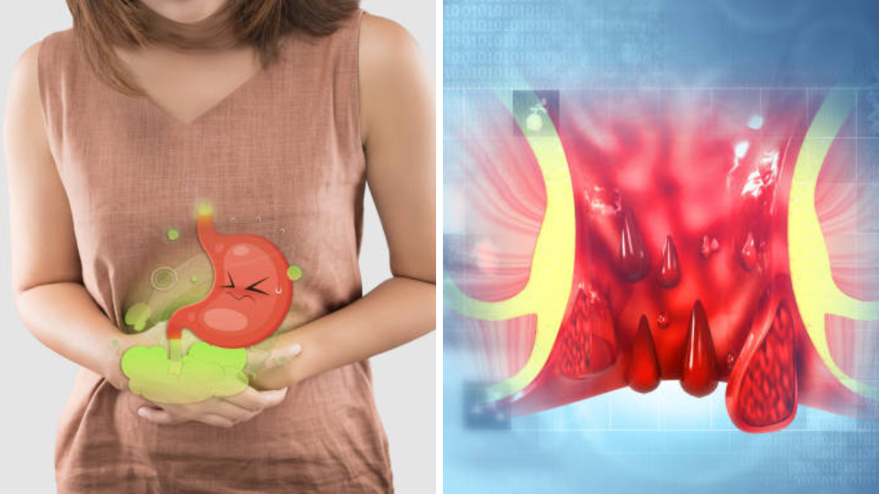 सकाळी 1 ग्लास गरम पाणी, गॅस्ट्रॉलॉजिस्टचे 6 देशी उपाय; गॅस-बद्धकोष्ठता, सडलेले शौच मुळापासून टाकेल उपटून