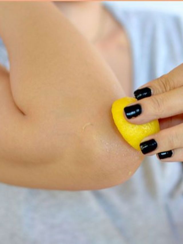 कोपराचा काळेपणा दूर करण्यासाठी जाणून घ्या या सोप्या टिप्स