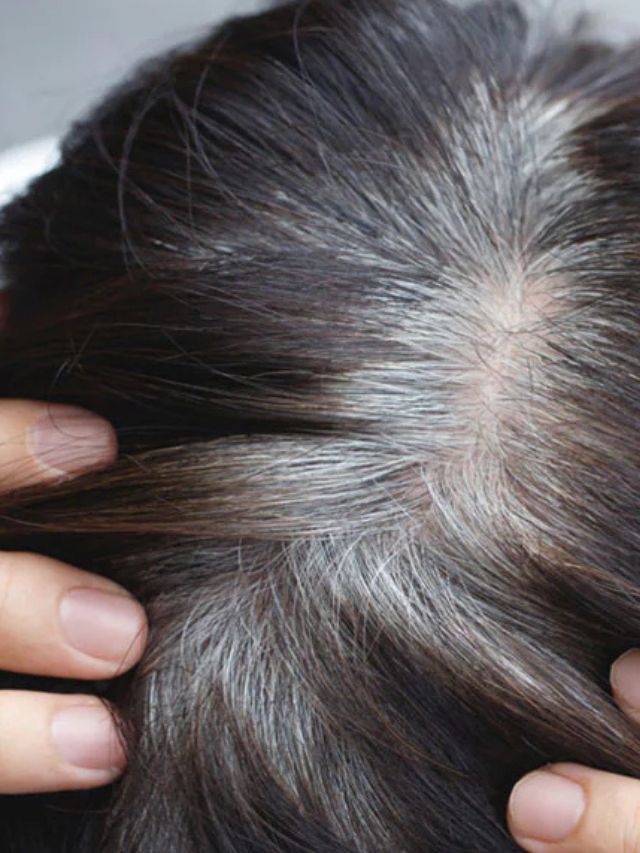 'या' व्हिटामीनच्या कमतरतेमुळे केस होतात पांढरे