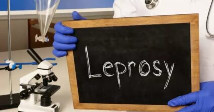 रायगड जिल्ह्यात कुष्ठरोग शोध मोहिमेला यश; १५१ रुग्णांची ओळख