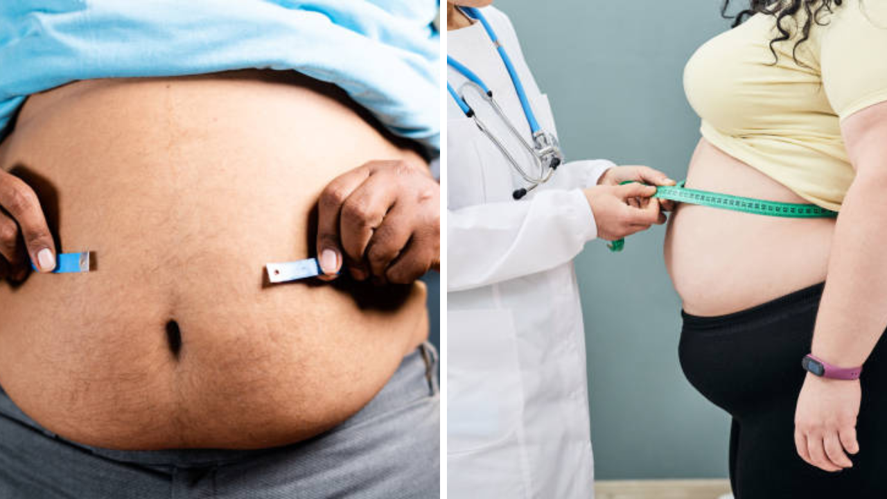 Explainer: लठ्ठपणा मस्करीचा विषय नाही! वर्षाला 28 लाख मृत्युमुुखी, पुरूष-महिलांच्या वंध्यत्वाचे कारण, किती आहे धोकादायक?