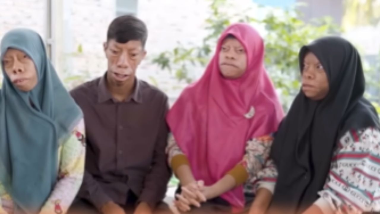 अजूनही त्यांना नक्की कोणता आजार झाला आहे याचा सुगावा लागला नाही. त्यामुळेच हा खरोखरंच कोणता अनुवांशिक आजार आहे की, यामागे आणखी काही रहस्य दडलेले हे गूढ अजून गुलदस्त्यातच आहे. 
