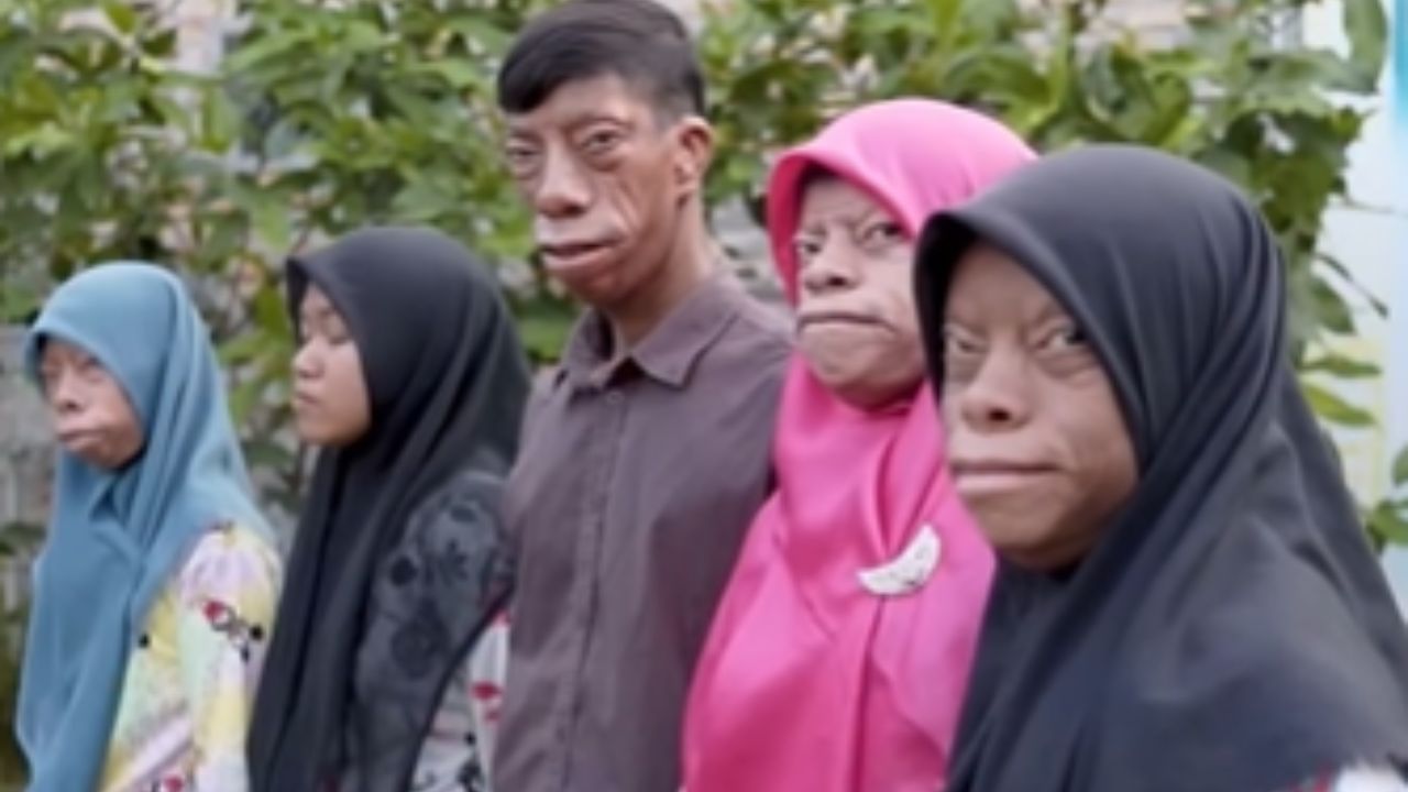 सकाळी माणूस, संध्याकाळी बनला सरडा… संपूर्ण गाव भयभीत; शास्त्रज्ञांनाही उलगडलं नाही कुटुंबाच रहस्य