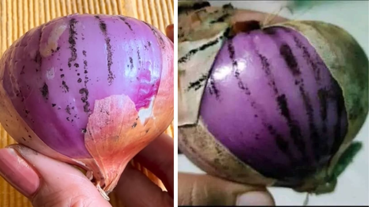 काळे डाग असलेला कांदा खाताय? ही छोटी चूक ठरू शकते आरोग्यास घातक; किडनीवर होतो परिणाम