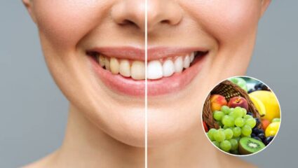 पिवळसर, काळ्या दातांवर आणा सफेदी; दातांना चमकवण्यासाठी करा या फळांचे सेवन