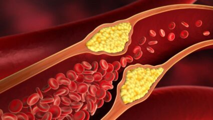 थंडीत कोलेस्ट्रॉल वाढले आहे का? न्यूट्रोशनिस्टने सांगितले 3 भाज्यांचे सेवन जे कोणत्या औषधाहून कमी नाही