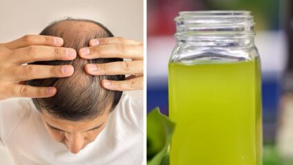 टक्कल पडलेल्या टाळूवर पुन्हा केस उगवायचा आहेत? मग नारळाच्या तेलात या 2 गोष्टी मिसळून मसाज करा आणि कमाल पहा