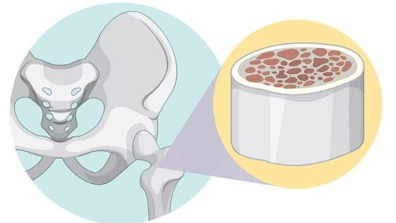 Apollo Hosiptal: चार वर्षीय लहानग्यावर ‘हॅप्लो-आइडेंटिकल बोन मॅरो ट्रान्सप्लांट’ यशस्वी!