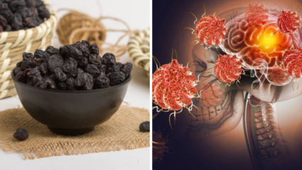 मेंदूसाठी धोकादायक असू शकतात मनुका, मायग्रेनसाठी सायलंट ट्रिगर; जास्त सतर्क राहण्याची गरज