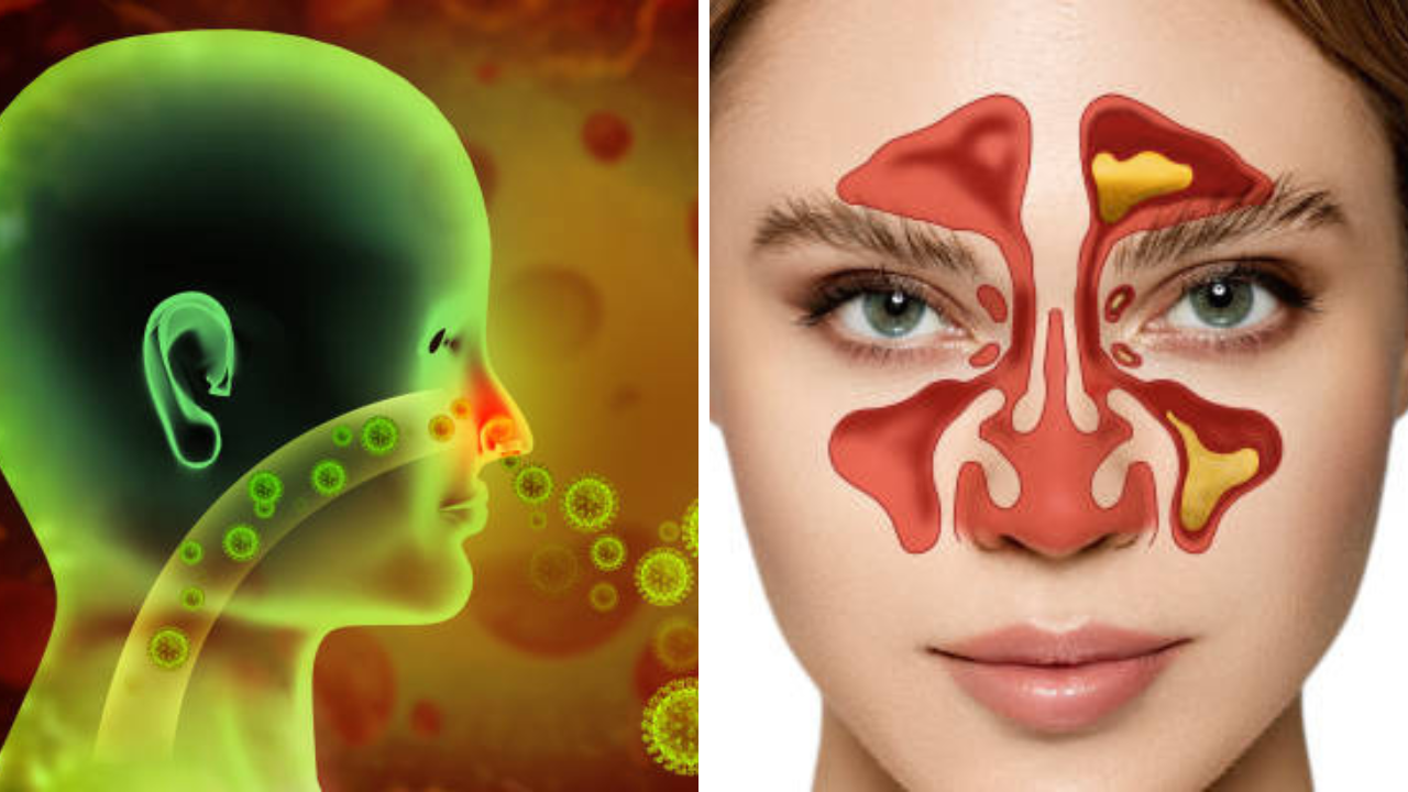 वाढत्या Sinusitis च्या ५०% रुग्णांसाठी कामाची जागा कारणीभूत, लक्षणे आणि उपाय