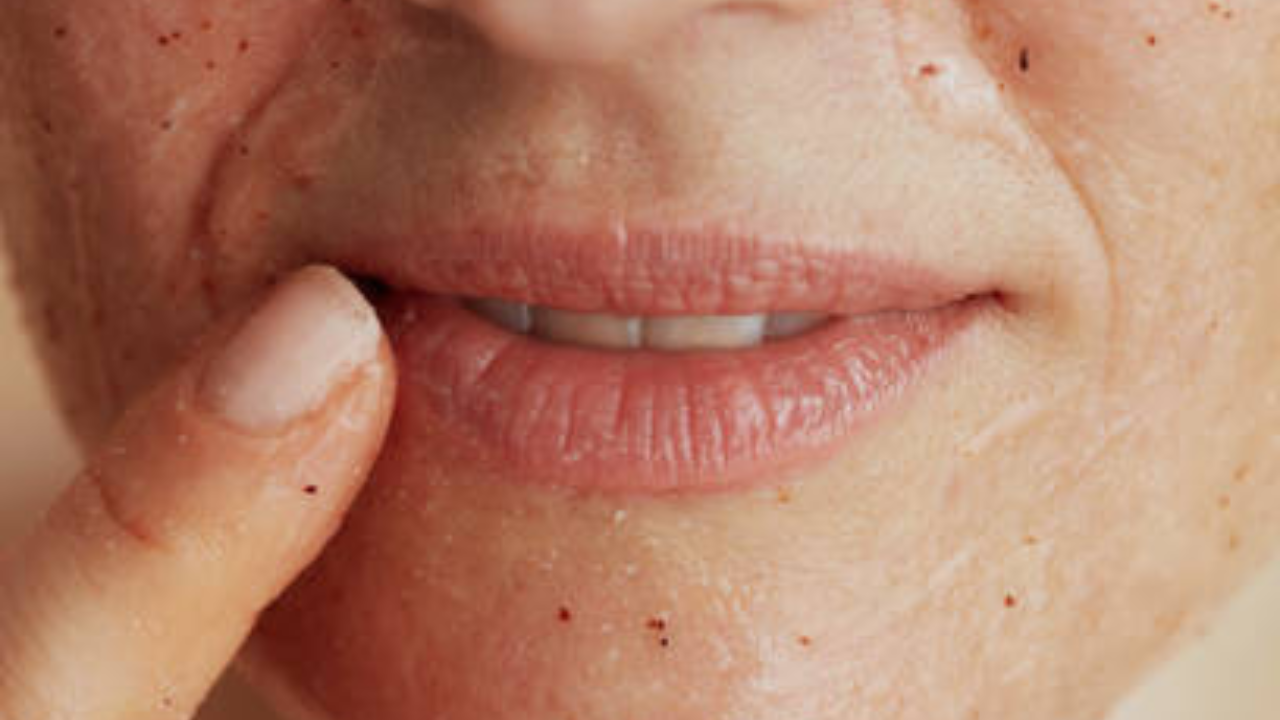 जर तुमचे ओठ फाटलेले किंवा कोरडे असतील तर त्यांना तूप लावणे अत्यंत फायदेशीर आहे. डोळ्यांभोवती थोडेसे तूप लावल्याने त्वचा उजळते, सौंदर्य वाढते आणि काळी वर्तुळे कमी होतात