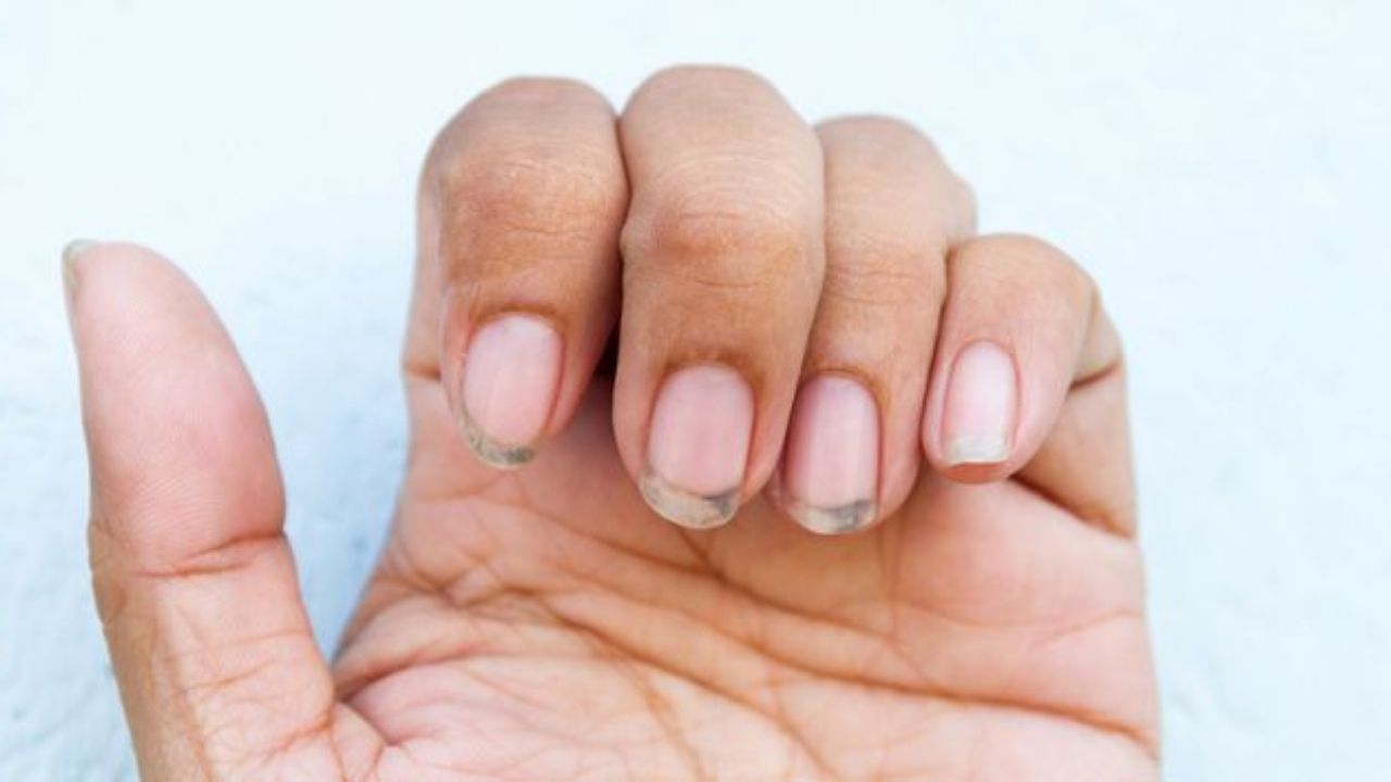 Astro Tips: अस्वच्छ नखांमुळे ग्रहदोष वाढतो, जीवनात वाढू शकते अपयश आणि दारिद्र्य