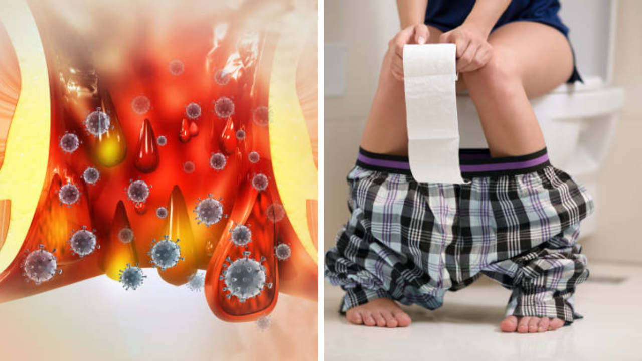 Constipation Test: 2 दिवसातून एकदा पोट साफ होणे योग्य? बद्धकोष्ठता आहे की नाही कसे समजून घ्याल