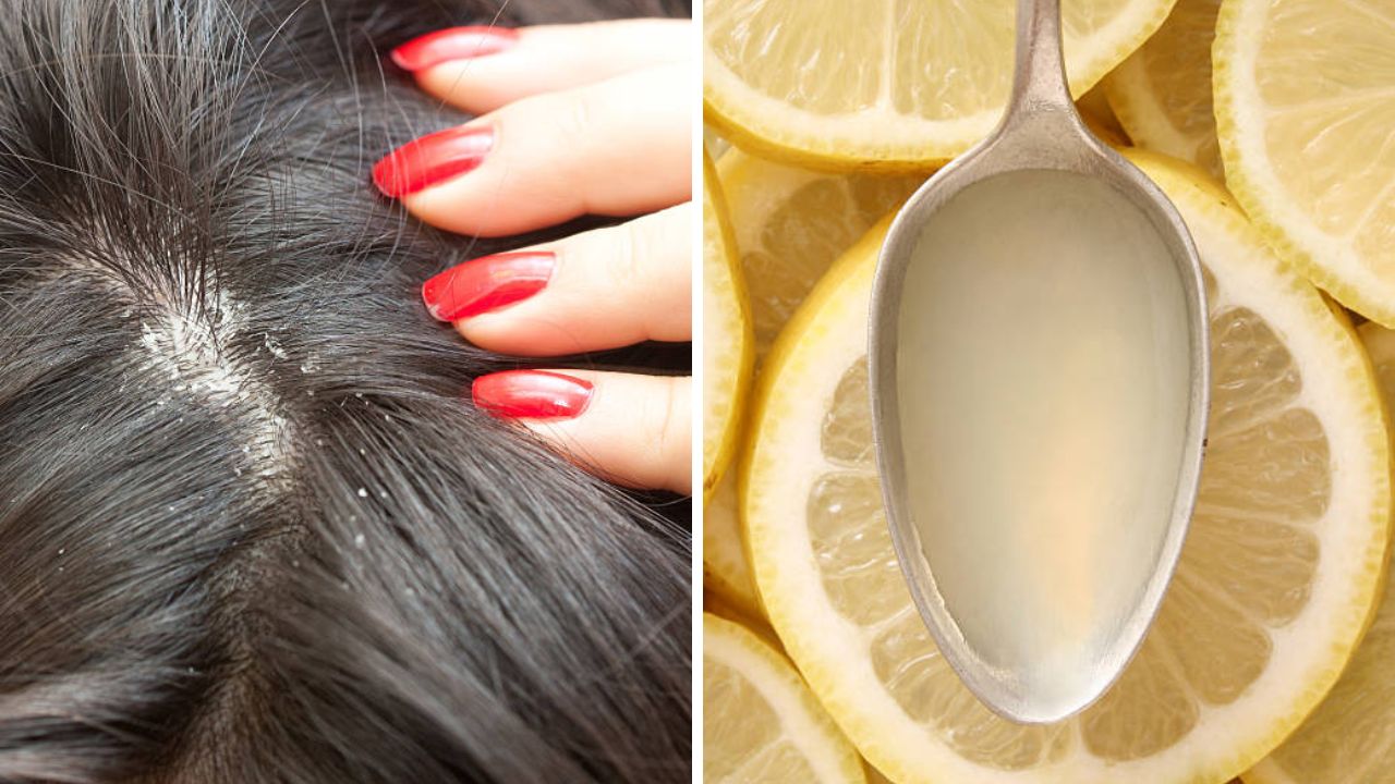 केसांच्या निरोगी आणि लांबलचक वाढीसाठी ‘या’ पद्धतीने करा लिंबाच्या रसाचा वापर, आठवडाभरात दिसून येईल कमाल